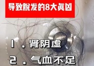 导致脱发的8个原因是什么？如何预防和治疗？