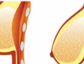 哺乳期不能烫发是误区吗？真相是什么？