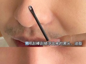 正确去黑头的方法是什么？如何避免常见的去黑头误区？