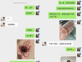 头发掉的太严重的解决办法？如何有效减少脱发问题？