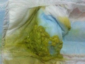宝宝拉绿色排泄物是什么原因？如何处理？