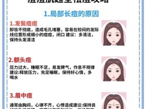 额头痘痘怎么快速消除？有效方法有哪些？
