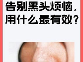 鼻子上的黑头怎么去掉？试试这些简单有效的小妙招吧！