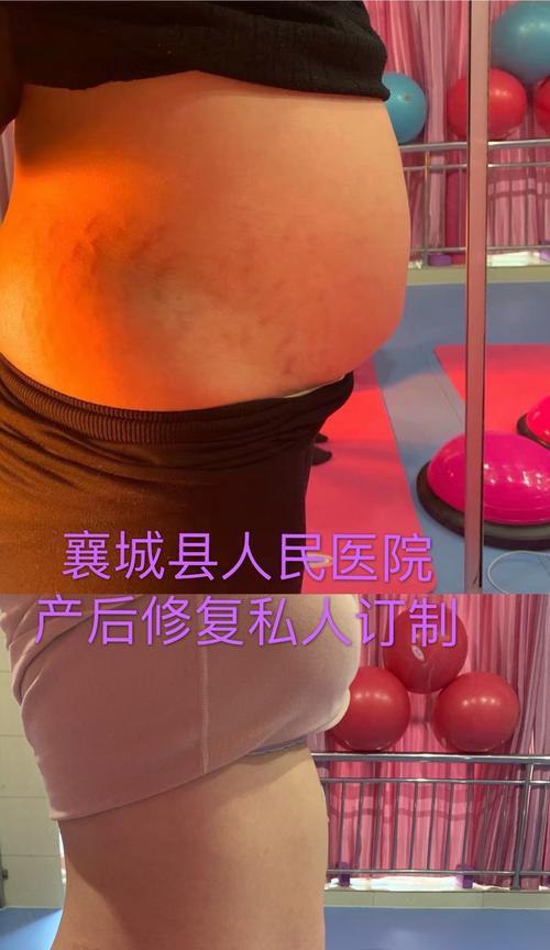 产后形体恢复的原则（如何科学）  第1张