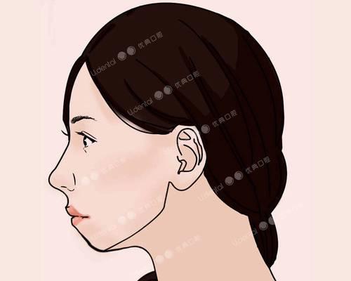 改善龅牙小妙招？有效方法有哪些？  第2张