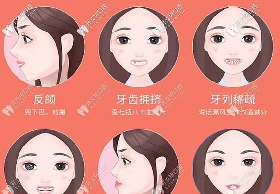 改善龅牙小妙招？有效方法有哪些？  第1张