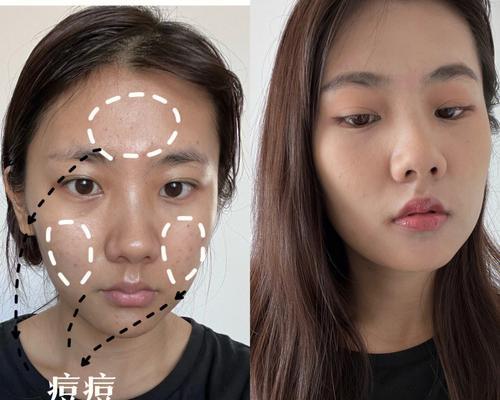 肤色不均是什么原因造成的？如何有效改善？  第2张