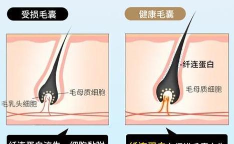 如何让头发变得更浓密？有哪些有效的方法？  第2张