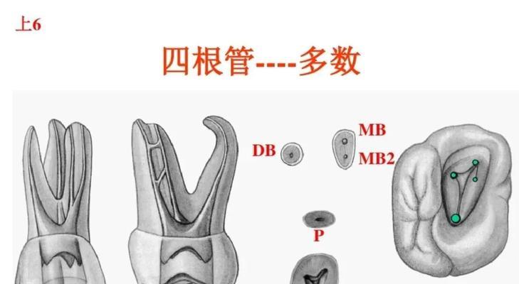 磨牙最好的解决方法是什么？如何有效缓解夜间磨牙问题？  第2张