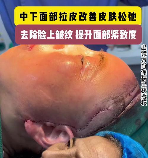 改善皮肤松弛最好的方法是什么？有效改善皮肤松弛的秘诀有哪些？  第1张