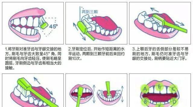 电动牙刷和普通牙刷哪个更好？各自的优缺点是什么？  第1张