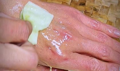白醋洗脸的正确方法是什么？如何避免常见的误区？  第2张