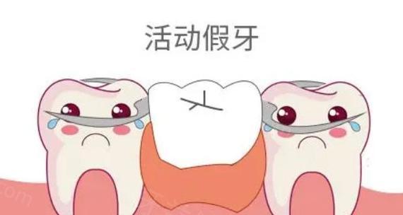 拔牙后镶牙的最佳时间是什么时候？多久进行修复最合适？  第3张