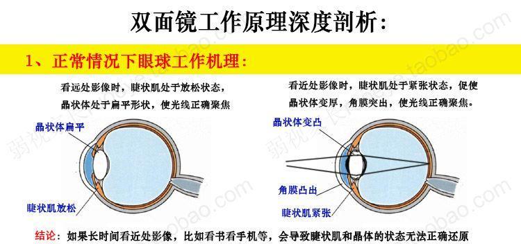 视力矫正训练方法有哪些？如何选择适合自己的训练方式？  第2张