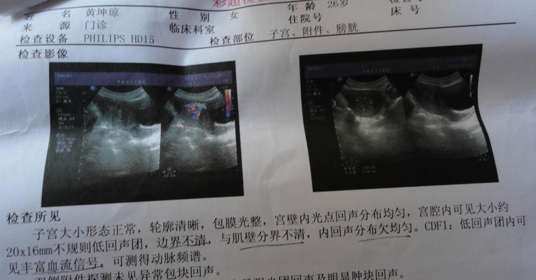 怀孕初期葡萄胎有哪些症状？如何识别葡萄胎的早期信号？  第3张