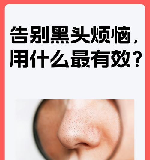 正确去黑头的方法是什么？如何避免常见的去黑头误区？  第3张