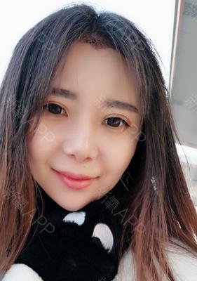 手机美人尖摄像头安装步骤是什么？安装后效果如何？  第2张