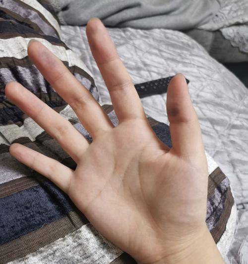 手机壳染上墨水如何清洗干净？  第1张