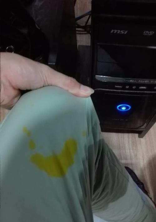 手机壳染上墨水如何清洗干净？  第2张